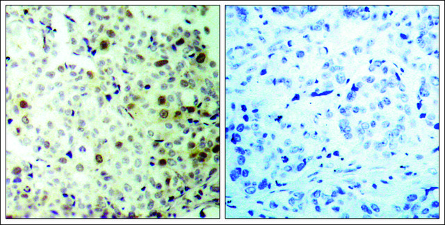 Anti-phospho-CDK2 (pThr160) antibody produced in rabbit affinity isolated antibody