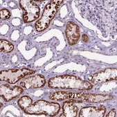 Anti-KMO antibody produced in rabbit Prestige Antibodies® Powered by Atlas Antibodies, affinity isolated antibody, buffered aqueous glycerol solution