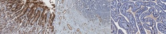 Anti-SPMD3 (nSMase2) Antibody, clone 14G5.1 clone 14G5.1, from mouse