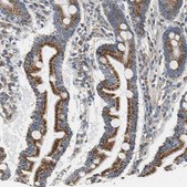 Anti-GSTK1 antibody produced in rabbit Prestige Antibodies® Powered by Atlas Antibodies, affinity isolated antibody, buffered aqueous glycerol solution