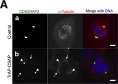 Anti-CDK5RAP2 Antibody from rabbit, purified by affinity chromatography