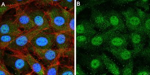 Anti-Treslin Antibody, clone 5L19 ZooMAb® Rabbit Monoclonal recombinant, expressed in HEK 293 cells