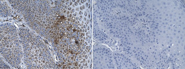 Anti-ZFP36L2 Antibody, clone 1E10 ZooMAb&#174; Rabbit Monoclonal recombinant, expressed in HEK 293 cells