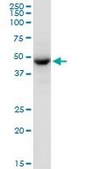 Anti-TUFM antibody produced in mouse purified immunoglobulin, buffered aqueous solution