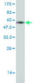 Monoclonal Anti-CRYGD antibody produced in mouse clone 4E12, purified immunoglobulin, buffered aqueous solution