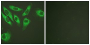Anti-S6 Ribosomal Protein, C-Terminal antibody produced in rabbit affinity isolated antibody