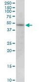 Anti-PIP4K2B antibody produced in mouse purified immunoglobulin, buffered aqueous solution