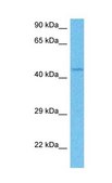 Anti-ETV4 antibody produced in rabbit affinity isolated antibody