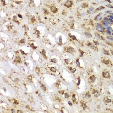 Anti-SGK1 antibody produced in rabbit