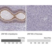 Anti-ZNF185 antibody produced in rabbit Ab1, Prestige Antibodies® Powered by Atlas Antibodies, affinity isolated antibody, buffered aqueous glycerol solution
