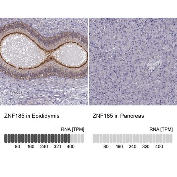 Anti-ZNF185 antibody produced in rabbit Ab1, Prestige Antibodies&#174; Powered by Atlas Antibodies, affinity isolated antibody, buffered aqueous glycerol solution