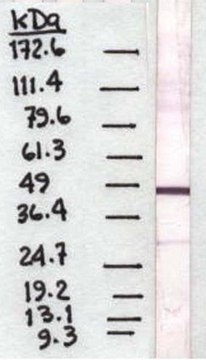 Anti-Pigment Epithelium Derived Factor Antibody, clone 10F12.2 clone 10F12.2, Chemicon&#174;, from mouse