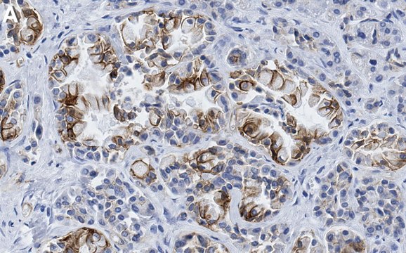 Anti-SLC12A2 Antibody, clone 1J6 ZooMAb&#174; Rabbit Monoclonal recombinant, expressed in HEK 293 cells