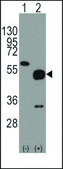 Anti-JUNCTOPHILIN 3 (C-term) antibody produced in rabbit IgG fraction of antiserum, buffered aqueous solution