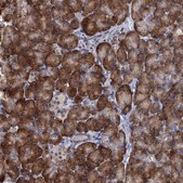 Anti-ALKBH7 antibody produced in rabbit Prestige Antibodies® Powered by Atlas Antibodies, affinity isolated antibody, buffered aqueous glycerol solution