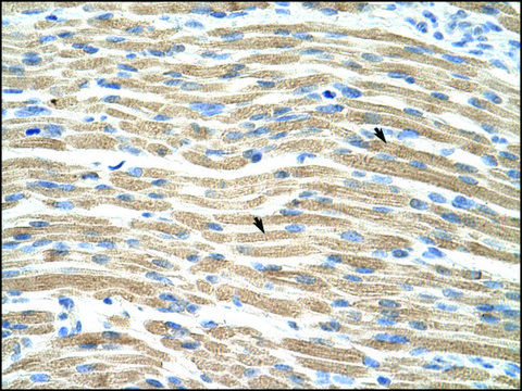 抗-TEAD1 (AB1) 兔抗 affinity isolated antibody