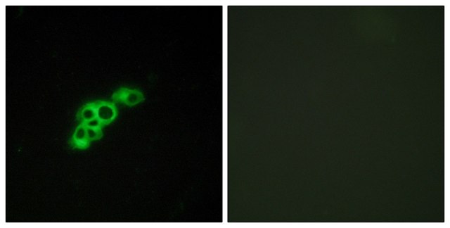 Anti-FSHR antibody produced in rabbit affinity isolated antibody