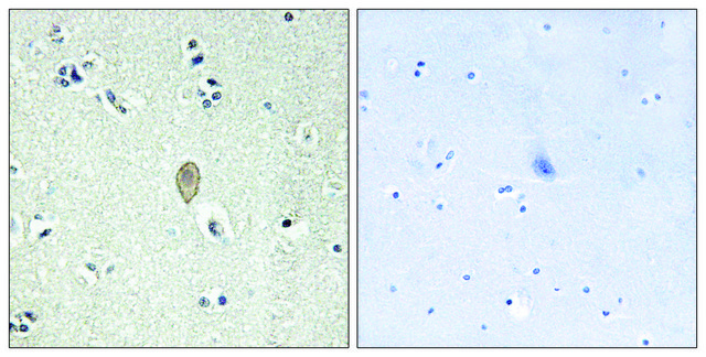 Anti-FZD5 antibody produced in rabbit affinity isolated antibody