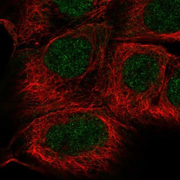 Anti-SGPP1 antibody produced in rabbit Prestige Antibodies&#174; Powered by Atlas Antibodies, affinity isolated antibody, buffered aqueous glycerol solution