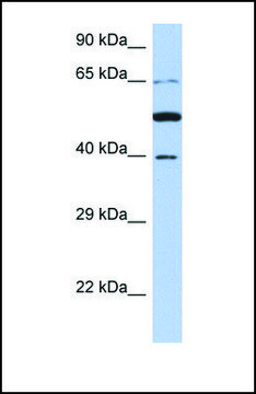 Anti-PNMA3, (N-terminal) antibody produced in rabbit affinity isolated antibody