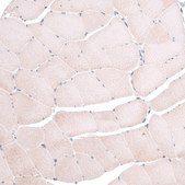 Anti-TSPAN13 antibody produced in rabbit Prestige Antibodies® Powered by Atlas Antibodies, affinity isolated antibody, buffered aqueous glycerol solution