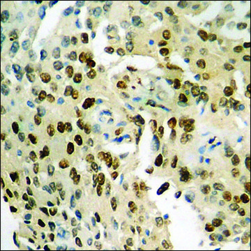 Anti-phospho-NF-kappaB p65 (pSer276) antibody produced in rabbit affinity isolated antibody