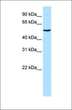 Anti-PPARA antibody produced in rabbit affinity isolated antibody