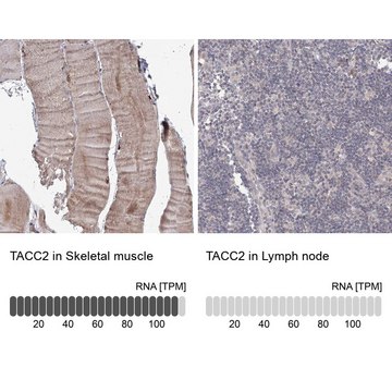 Anti-TACC2 antibody produced in rabbit Prestige Antibodies&#174; Powered by Atlas Antibodies, affinity isolated antibody, buffered aqueous glycerol solution