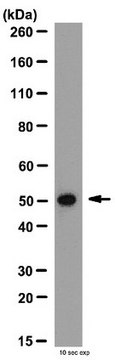 Anti-MMP-1 Antibody, hinge region from rabbit, purified by affinity chromatography