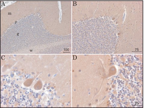 Anti-KCNK9 (TASK-3) antibody, Mouse monoclonal clone KCN-75, purified from hybridoma cell culture