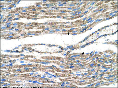 Anti-SLC2A6 antibody produced in rabbit IgG fraction of antiserum