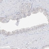 Anti-DCDC2 antibody produced in rabbit Prestige Antibodies® Powered by Atlas Antibodies, affinity isolated antibody, buffered aqueous glycerol solution