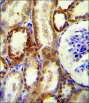 ANTI-CD73 (NT5E)(N-TERMINAL) antibody produced in rabbit IgG fraction of antiserum, buffered aqueous solution