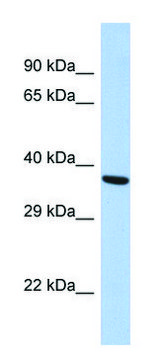 Anti-BDNF (N-terminal) antibody produced in rabbit affinity isolated antibody