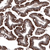 Monoclonal Anti-LAMP1 antibody produced in mouse Prestige Antibodies® Powered by Atlas Antibodies, clone CL4472, purified immunoglobulin