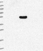 Anti-ARRDC4 antibody produced in rabbit Prestige Antibodies® Powered by Atlas Antibodies, affinity isolated antibody, buffered aqueous glycerol solution