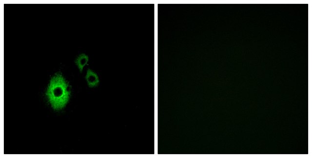 Anti-KCNJ5 antibody produced in rabbit affinity isolated antibody