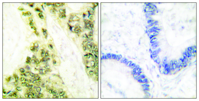 Anti-Thyroid Hormone Receptor &#945;, N-Terminal antibody produced in rabbit affinity isolated antibody