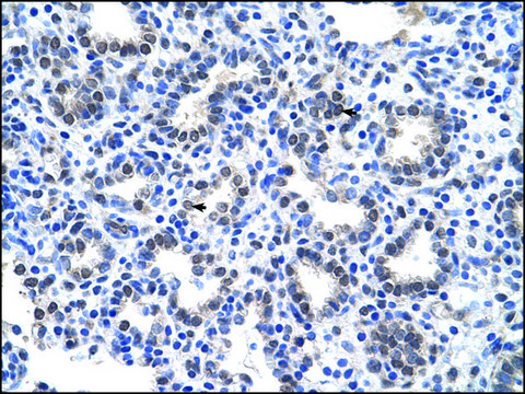 Anti-SLC22A16 antibody produced in rabbit IgG fraction of antiserum