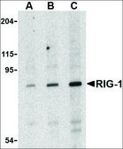 Anti-RIG-1 antibody produced in rabbit affinity isolated antibody, buffered aqueous solution