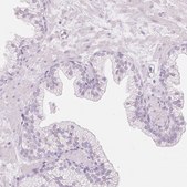 Anti-LECT2 antibody produced in rabbit Prestige Antibodies® Powered by Atlas Antibodies, affinity isolated antibody, buffered aqueous glycerol solution