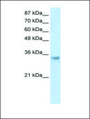 Anti-RNASEH2A antibody produced in rabbit IgG fraction of antiserum