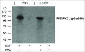 Anti-phospho-PRKD1 (pSer910) antibody produced in rabbit affinity isolated antibody