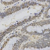 Anti-TriMethyl-Histone H3-K4 antibody produced in rabbit
