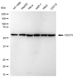 KD-Validated Anti CDC73 Antibody, clone 23GB3450, Rabbit Monoclonal clone 23GB3450, recombinant rabbit monoclonal, expressed in HEK293 cells