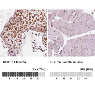 Anti-IKBIP antibody produced in rabbit Prestige Antibodies&#174; Powered by Atlas Antibodies, affinity isolated antibody