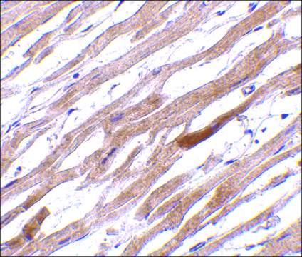 Anti-TIRAP (ab1) antibody produced in rabbit affinity isolated antibody, buffered aqueous solution