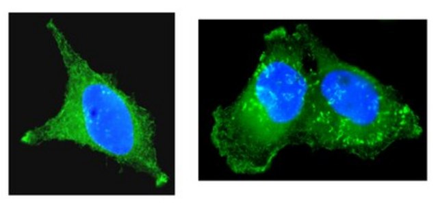 Anti-Cortactin (p80/85) Antibody, clone 4F11, Alexa Fluor&#8482; 488 clone 4F11, Upstate&#174;, from mouse