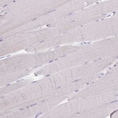 Anti-CPB1 antibody produced in rabbit Prestige Antibodies® Powered by Atlas Antibodies, affinity isolated antibody, buffered aqueous glycerol solution