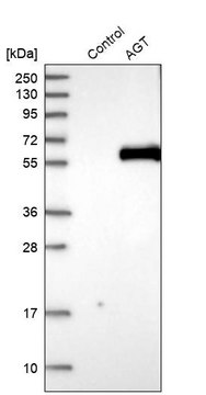 Anti-AGT antibody produced in rabbit Prestige Antibodies&#174; Powered by Atlas Antibodies, affinity isolated antibody, buffered aqueous glycerol solution